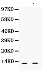 WB - Anti-S100 Alpha 6 Picoband Antibody ABO12362